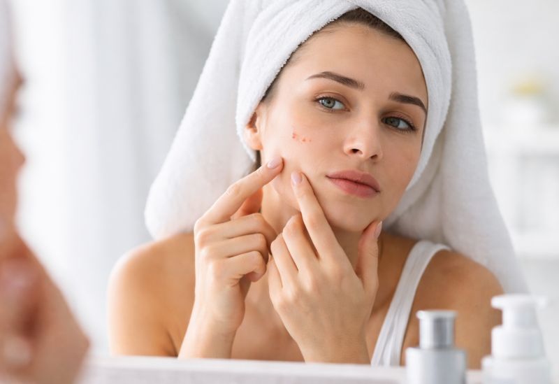 Acne: Understanding and Treating This Common Skin Condition