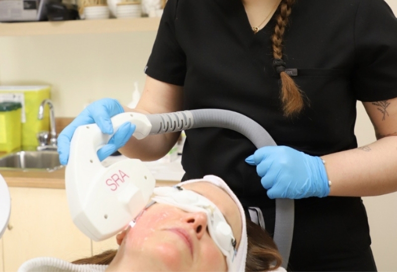 Taches brunes : comment le photorajeunissement chez Epiderma peut vous aider